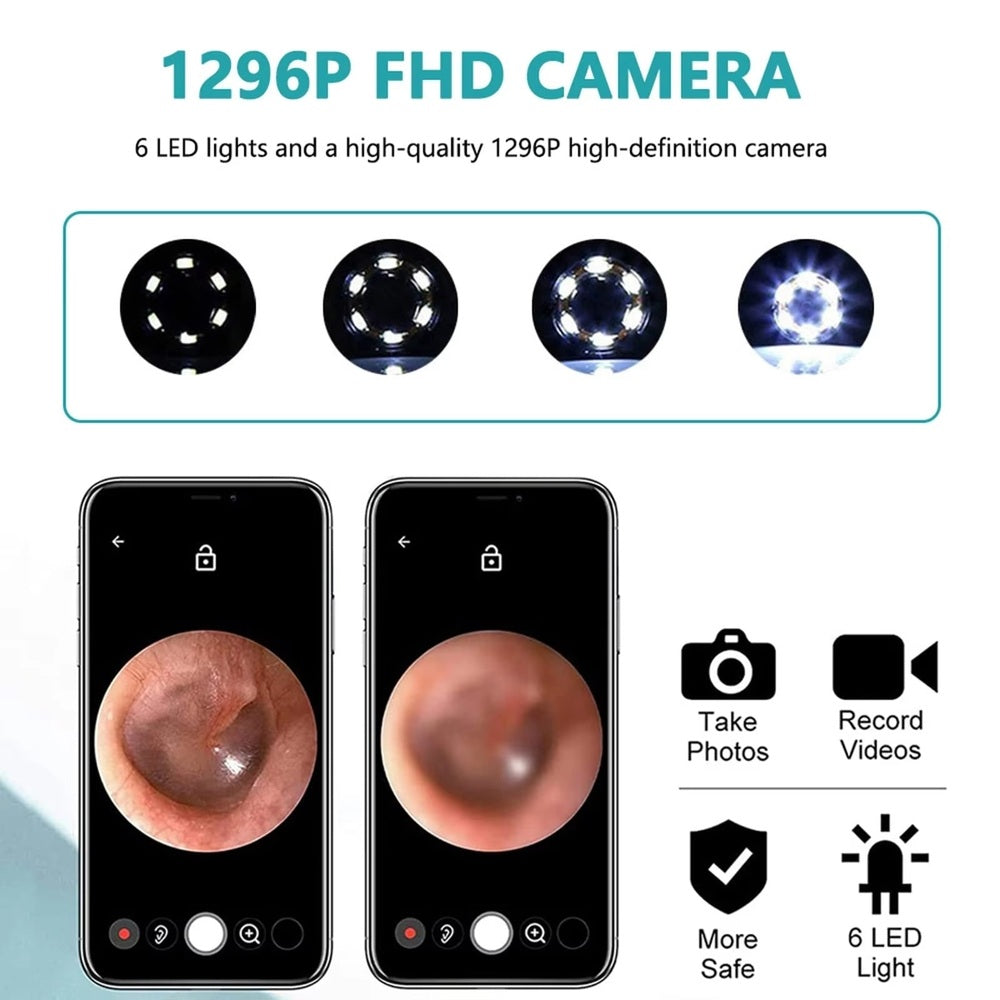 Smart Wireless Ear Cleaner – 1080P HD Camera Otoscope with 6 LED Lights & Wax Removal Kit